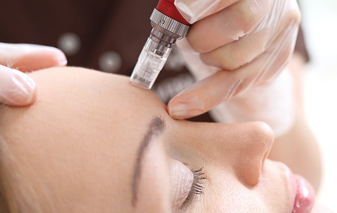 Sylfirm Microneedling